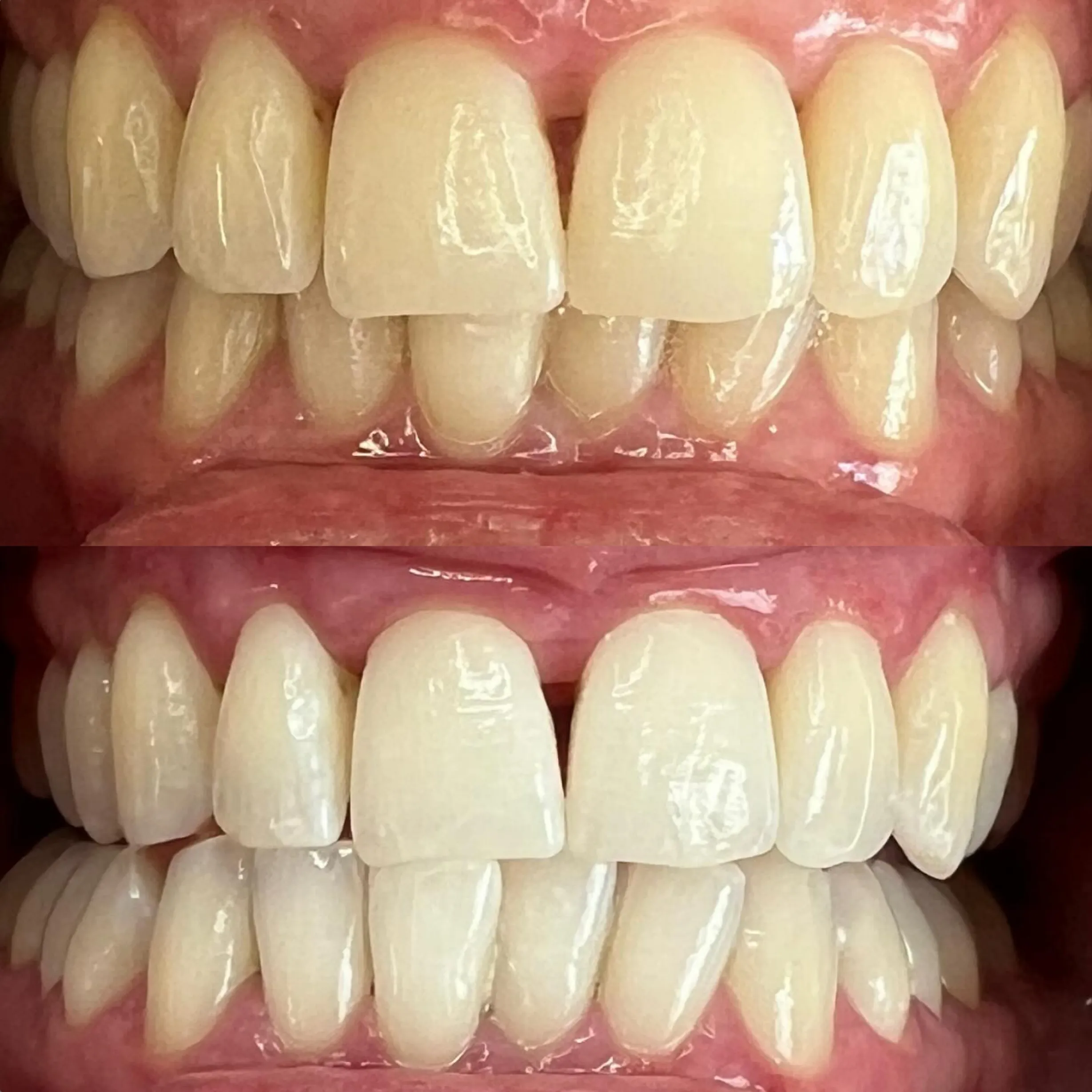 teeth whitening technician