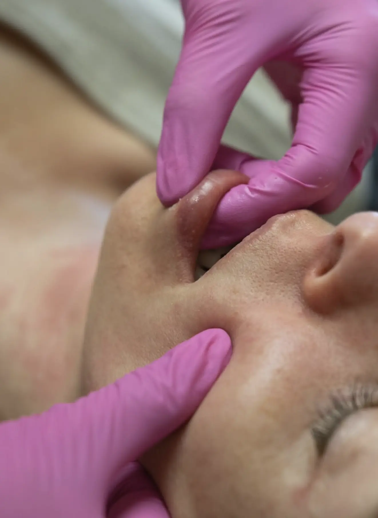 face sculpting